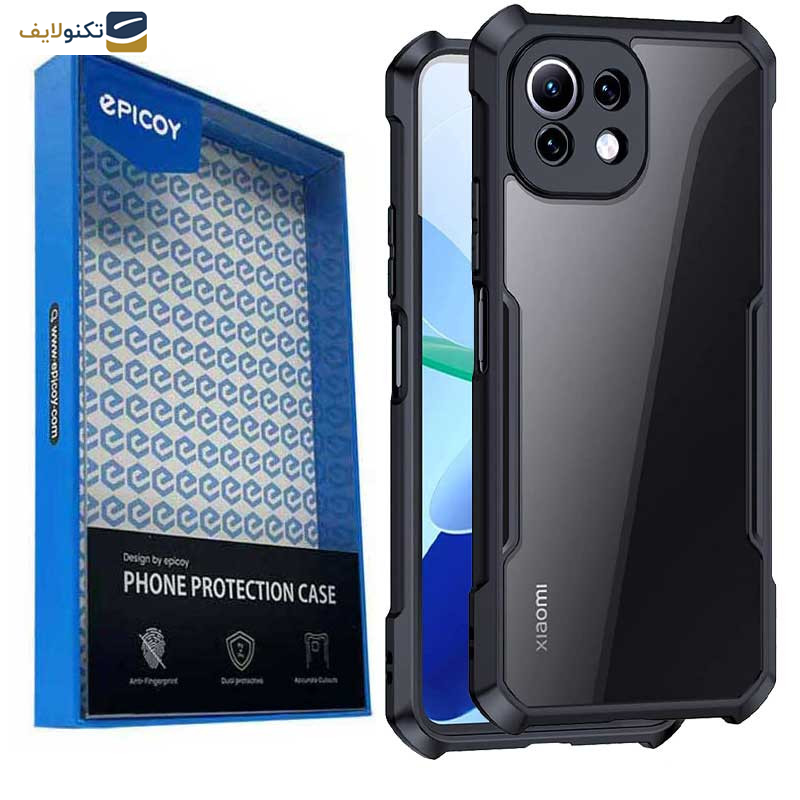کاور اپیکوی مدل Xundd Beatle مناسب برای گوشی موبایل شیائومی Mi 11 Lite 4G/5G / 11 Lite 5G NE کاور اپیکوی مدل Xundd Beatle مناسب برای گوشی موبایل شیائومی Mi 11 Lite 4G/5G / 11 Lite 5G NE