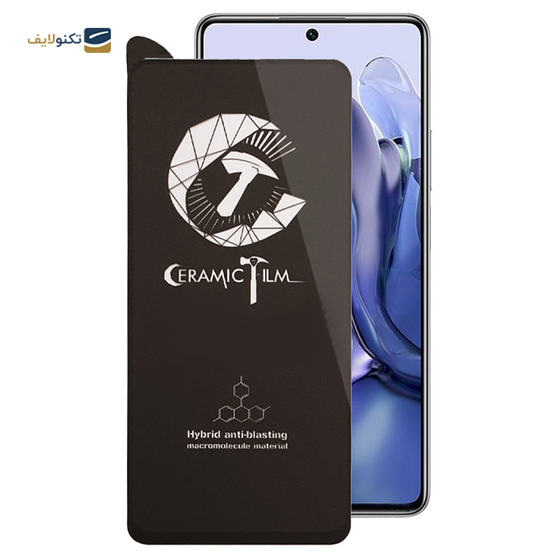 gallery-گلس گوشی شیائومی 11T /11T Pro اپیکوی مدل CR7 -gallery-0-TLP-21649_043e8dbe-0058-4986-a40a-db6da233d9bc.png gallery-گلس گوشی شیائومی 11T /11T Pro اپیکوی مدل CR7 -gallery-0-TLP-21649_043e8dbe-0058-4986-a40a-db6da233d9bc.png